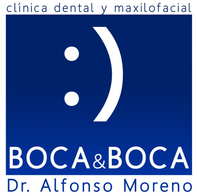 Implantes en Málaga Clínica dental Boca & Boca Avenida Velázquez.